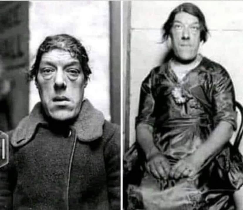Don t cry after reading this World s Ugliest Woman