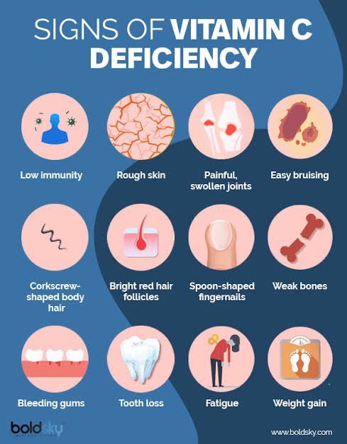 Vitamin C Deficiency is more dangerous