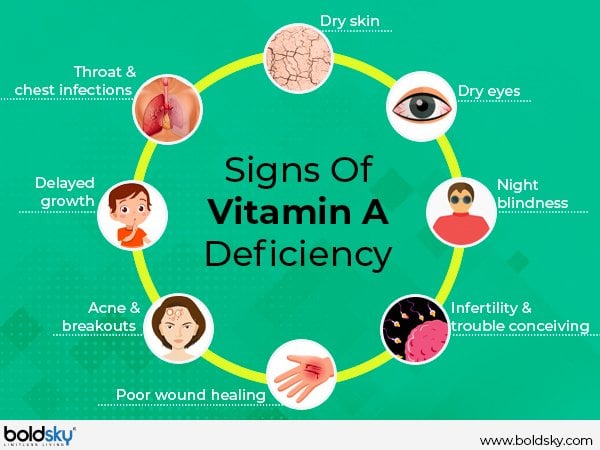Deficiency Of These Two Vitamins Leads To Loss Of Eyesight deficiency-of-these-two-vitamins-leads-to-loss-of-eyesight