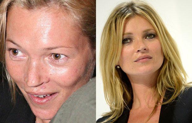 Shocking Photos of Actresses without make-up