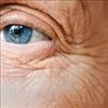 Wrinkles issue a remedy for aged people