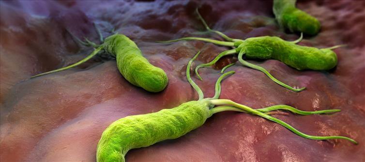 The Tiny Stomach Bacterium Linked to Millions of Cancer Cases Worldwide