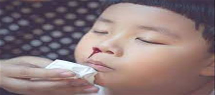 Attention parents..! Children's nose bleeding? Don't ignore it..!