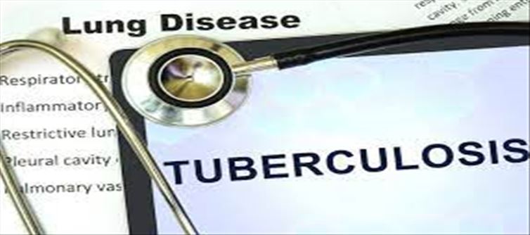 World Tuberculosis Day: Keep these Precautions in Mind...