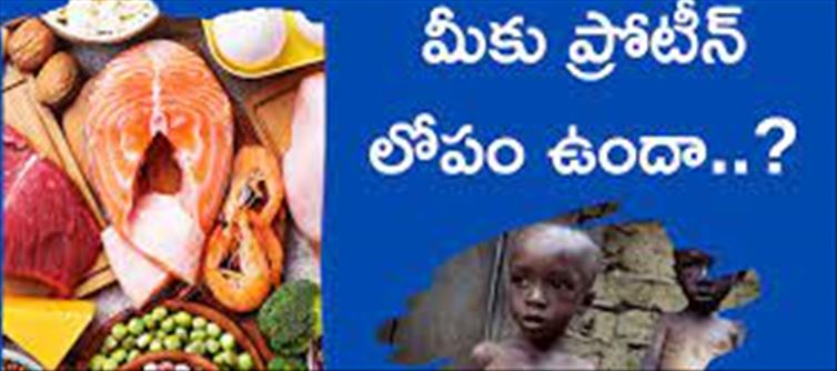 ప్రోటీన్ లోపంతో బాధపడుతున్నారా..ఇవి తిని చూడండి..!!