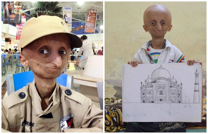 Aamir Khan Met The 14YearOld Kid Suffering From Progeria