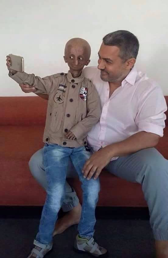 Aamir Khan Met The 14YearOld Kid Suffering From Progeria