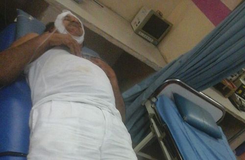 APCOB Chairman Pinnamaneni Venkateswara Rao Car Accident photos 