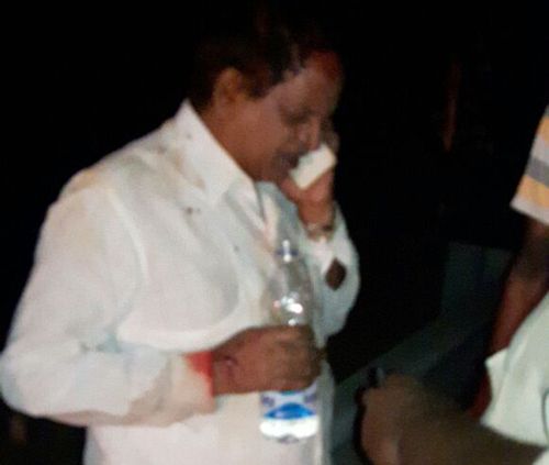 APCOB Chairman Pinnamaneni Venkateswara Rao Car Accident photos 