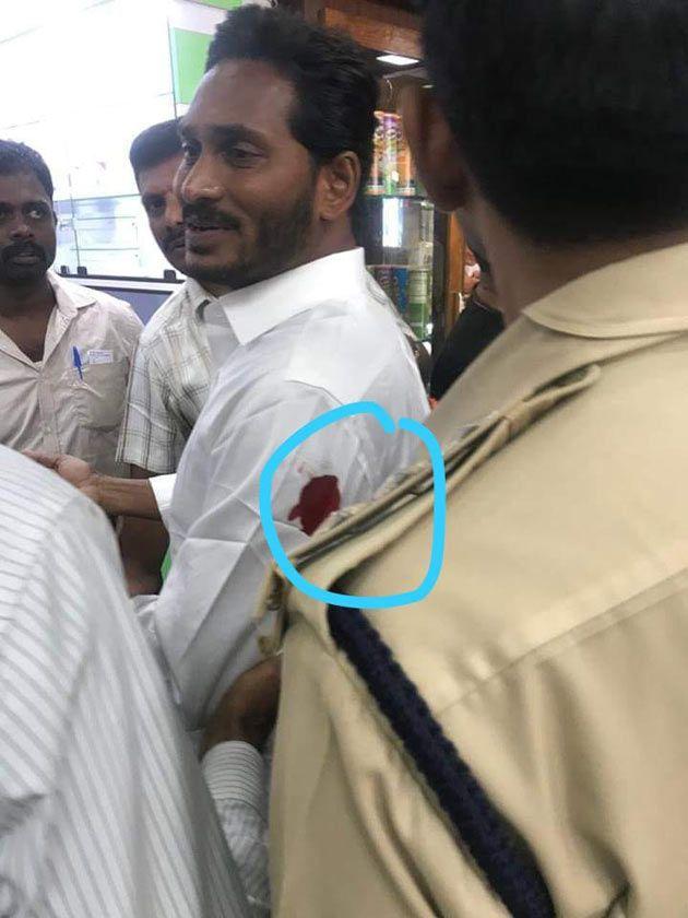 Attack on JAgan at Vizag Airport Pics