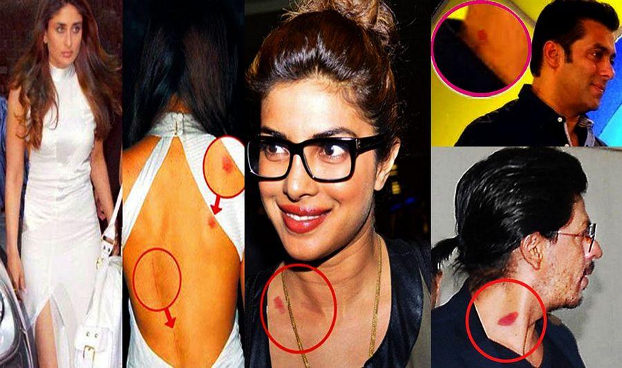 Celebrities Caught Publically Flaunting LOVE BITES on Body Photos