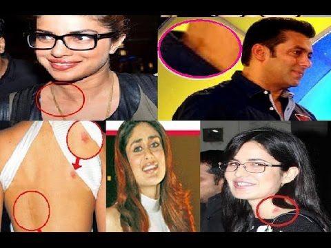 Celebrities Caught Publically Flaunting LOVE BITES on Body