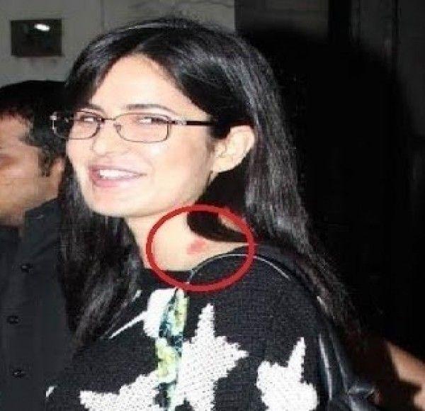 Celebrities Caught Publically Flaunting LOVE BITES on Body Photos