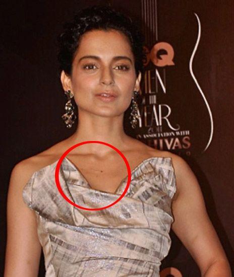Celebrities Caught Publically Flaunting LOVE BITES on Body Photos