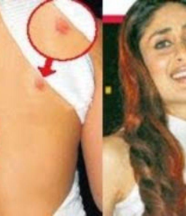 Celebrities Caught Publically Flaunting LOVE BITES on Body Photos