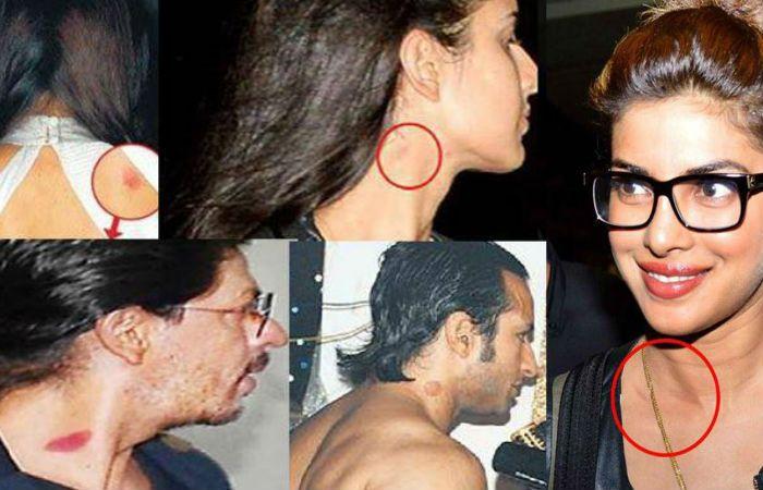 Celebrities Caught Publically Flaunting LOVE BITES on Body Photos