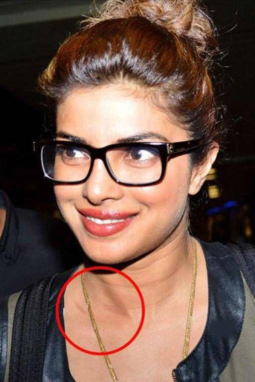 Celebrities Caught Publically Flaunting LOVE BITES on Body Photos
