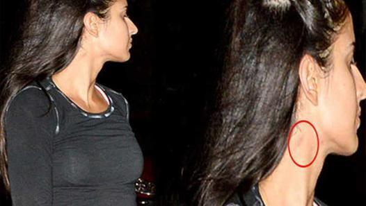 Celebrities Caught Publically Flaunting LOVE BITES on Body Photos