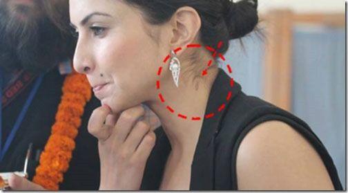 Celebrities Caught Publically Flaunting LOVE BITES on Body Photos