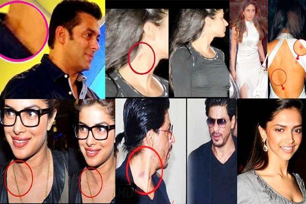 Celebrities Caught Publically Flaunting LOVE BITES on Body Photos