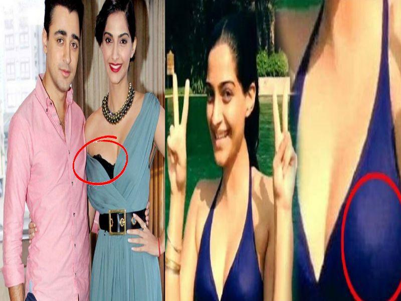 Most Embarrassing Celebrity Moments Photos