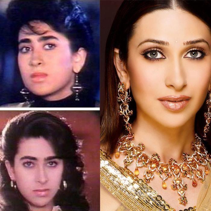 Celebs Before and After Cosmetic Surgery