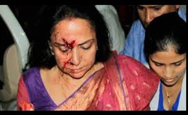 Hema Malini Injured Road Accident Photos