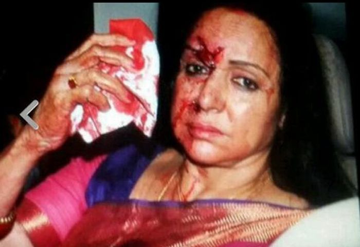 Hema Malini Injured Road Accident Photos