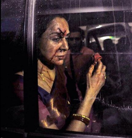 Hema Malini Injured Road Accident Photos