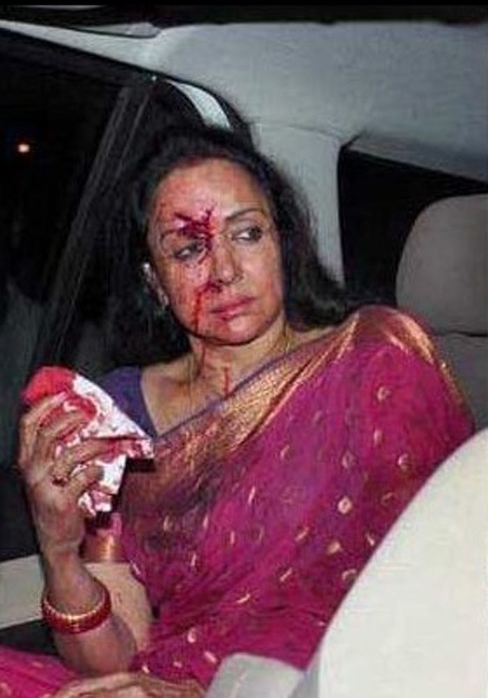 Hema Malini Injured Road Accident Photos