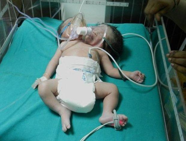 Medical Birth Miracles From Around The World That Are Shocking