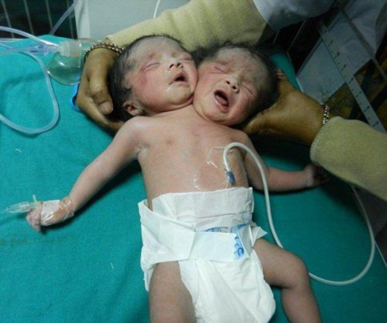 Medical Birth Miracles From Around The World That Are Shocking