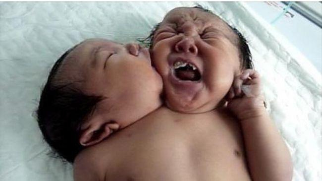 Medical Birth Miracles From Around The World That Are Shocking