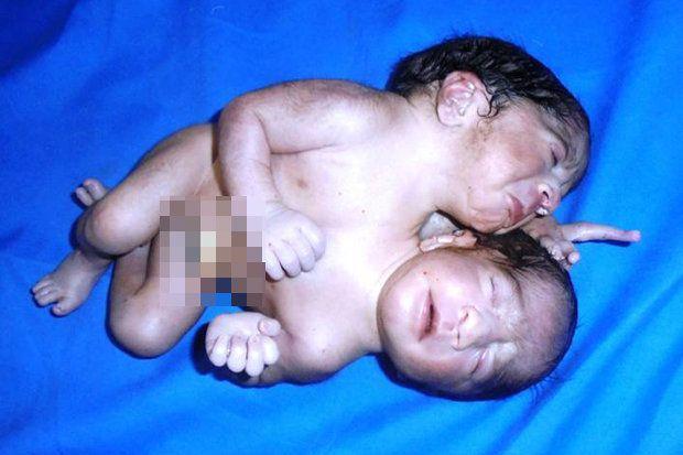 Medical Birth Miracles From Around The World That Are Shocking