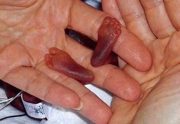 Smallest Things in the World