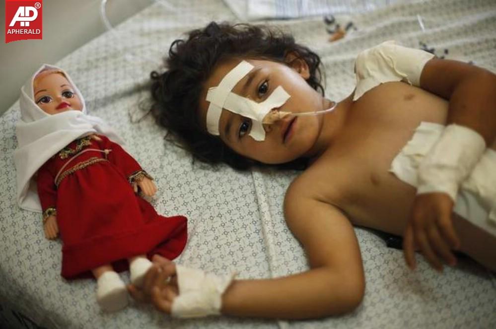 The Human Cost of the Israel-Gaza Conflict