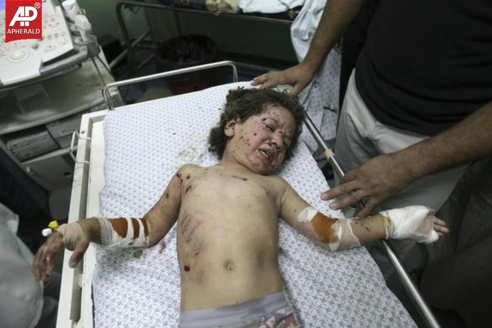 The Human Cost of the Israel-Gaza Conflict