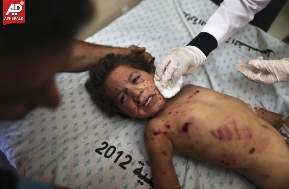 The Human Cost of the Israel-Gaza Conflict