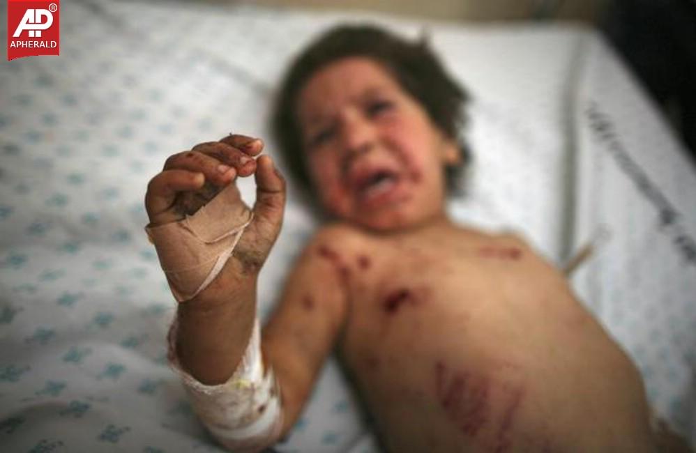 The Human Cost of the Israel-Gaza Conflict