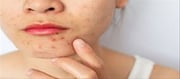 Bad Habits that are messing with your Dark Spots!!!