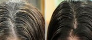 Homemade remedies to turn White Hair to Black without Chemical Dyes