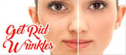 Remedies to treat Wrinkles in your House