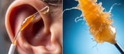 Doctor Reveals Wonderful Trick To Remove Ear Wax - Don't Use Oil or Hydrogen Peroxide
