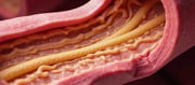 Eat this food before sleeping at night, the old cholesterol deposited in the blood vessels will dissolve quickly