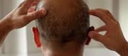 Fake hair Growth camp in Hyderabad..!?