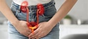 How to Check your Kidney Health Without Any Test? Urologist Reveals
