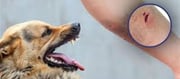 ICMR report reveals, target of rabies free India by 2030!