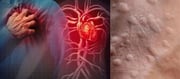 You Can Predict Heart Attack By Just Seeing Your Skin - See These Signs