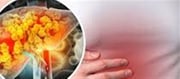 Can Fatty Liver Bring About Heart Troubles?