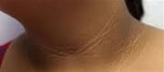 Darkish Ring Around Your Neck?